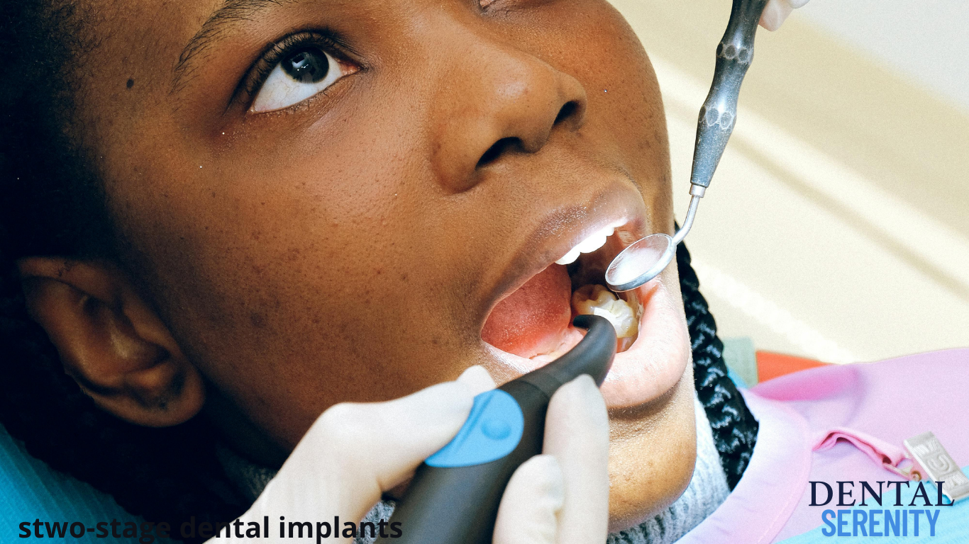 two-stage dental implants