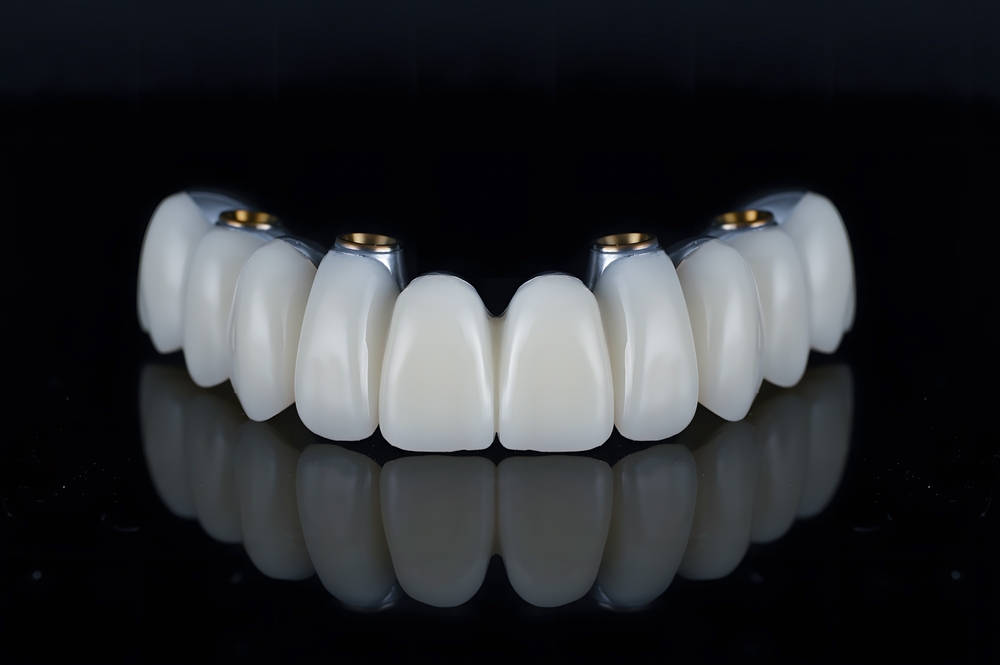 Does food get under all-on-4 dental implants?