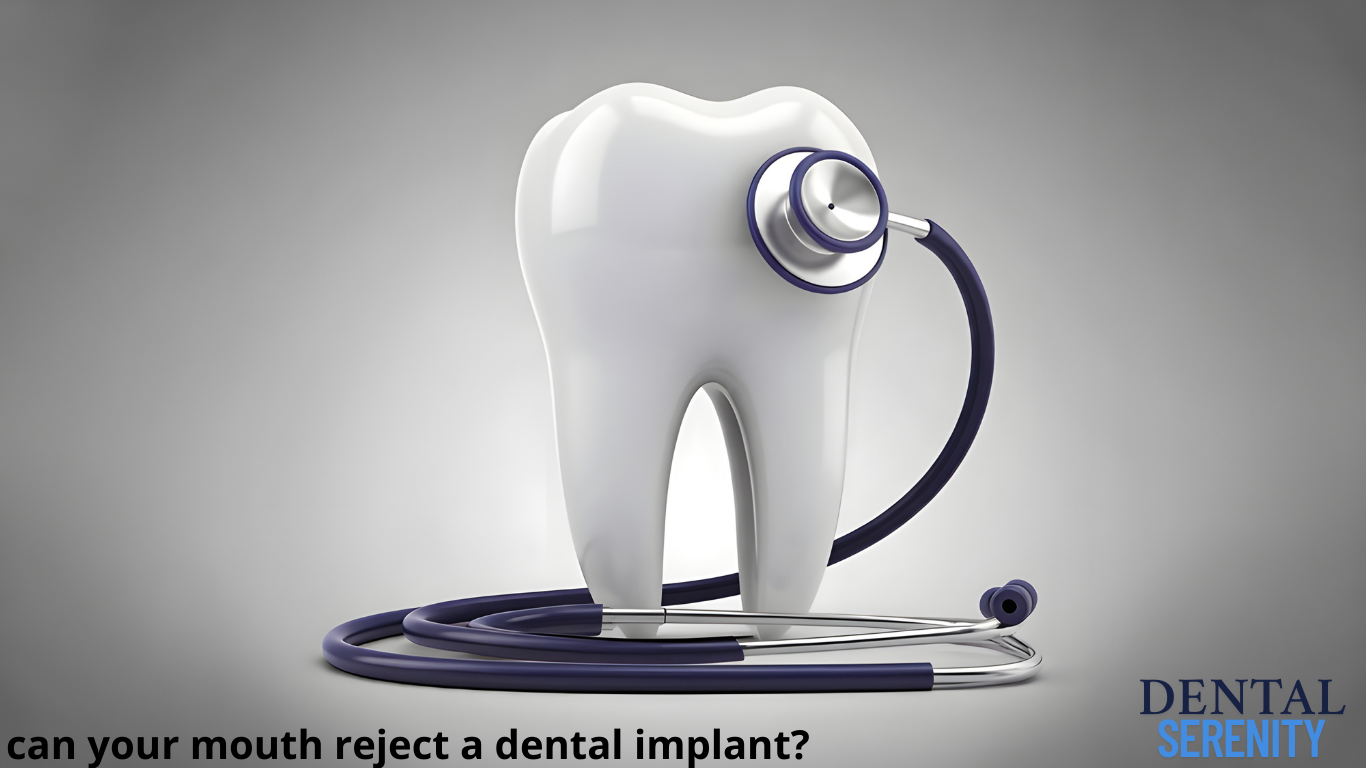 can your mouth reject a dental implant?
