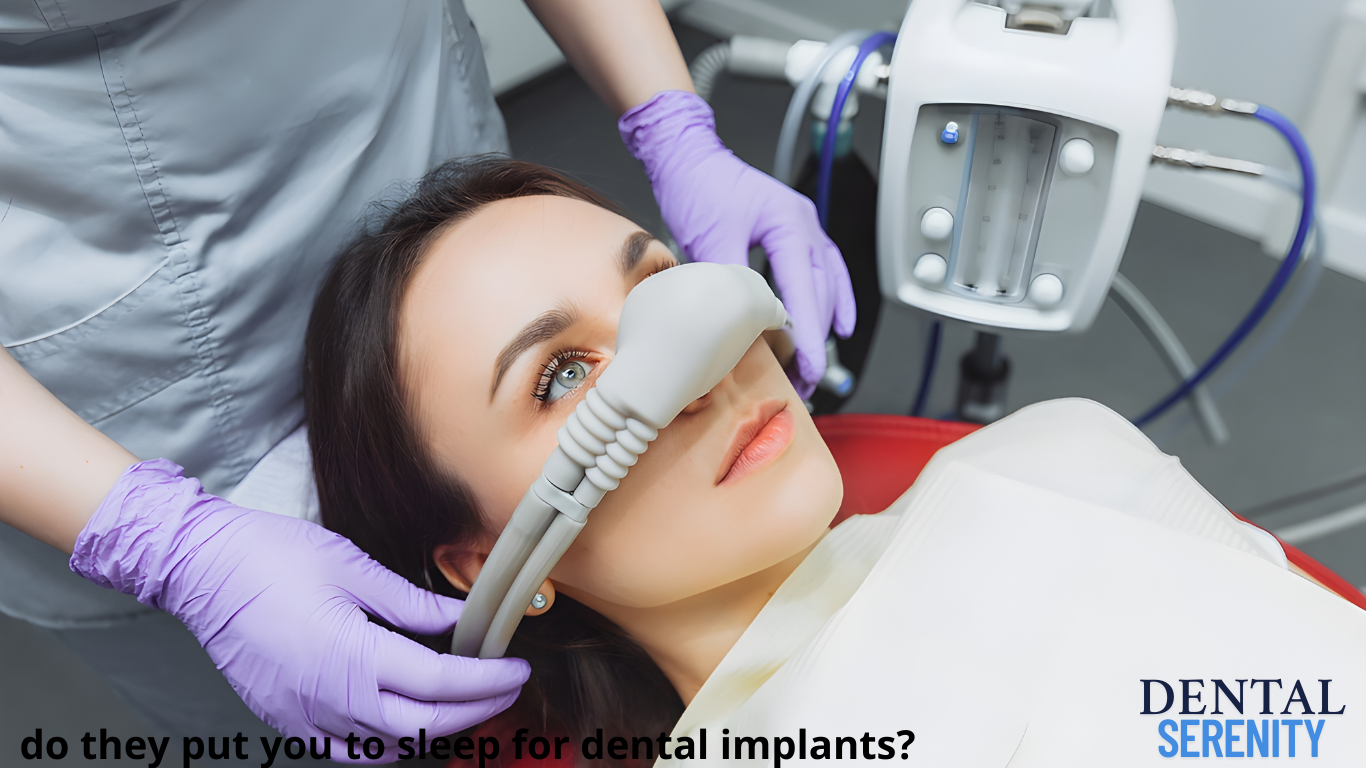 do they put you to sleep for dental implants?
